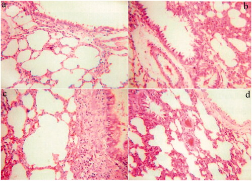 Figure 4. Representative photographs of lung tissue 24 h post-administration of the blank DPIs inhalation (a); the INS@FDKP-MPs inhalation (b); the Common INS inhalation (c); and the subcutaneous insulin injection (d) (magnification: ×200).
