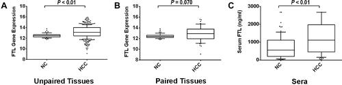 Figure 4 Elevated expression level of FTL in HCC. (A) Comparison of the expression of FTL gene between HCC tissues and unpaired normal liver tissues by RNA-Seq. (B) Comparison of the expression of FTL gene between HCC tissues and paired normal liver tissues by RNA-Seq. (C) Serum FTL concentration in HCC patients and normal controls.