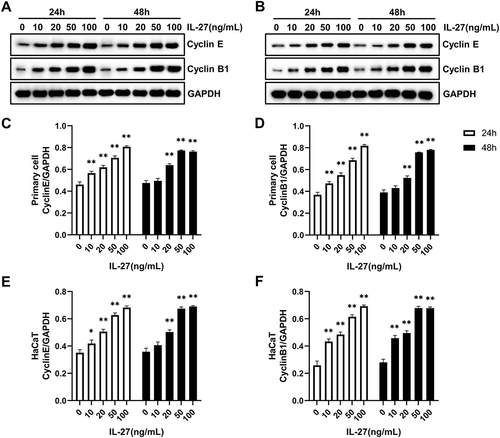 Figure 3 IL-27 concentration-dependently upregulated the protein levels of CyclinE and CyclinB1 in the primary cell and HaCaT. (A, C, and D) Western blot detected the protein levels of CyclinE and CyclinB1 in the primary cell at 24 h and 48 h after IL-27 intervention. (B, E, and F) Western blot detected the protein levels of CyclinE and CyclinB1 in HaCaT at 24 h and 48 h after IL-27 intervention. Data represent mean ± standard deviation. n=3 for each group. Compared with the 0 ng/mL IL-27 group, *P<0.05, ** P<0.001.