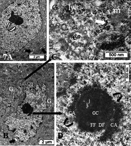 Figure 7. (a–d): HN neuron cell bodies of the parenchyma of the latero-ventral thalamic parenchyma showing the nucleus topology change (a–b) as well as the nucleolus. (a and b) segregation of the nucleolus CA/DF regions from GC component (curved arrows in A and D) suggestive of a reduced or stoppage in ranscriptional activities because accumulated ribonucleoproteins (GC) amassed separated from the chromatin (CA) becoming concentric of GC, and its extension as dense fibrillar (DF). The fine fibrillar region (pale circles in nucleolus depicting transcription (FF) is absent. In the GC mass, interstices are formed (I) as CA leaves the nucleolus. Example of perikaryon of (b) in (c) revealed scattered free polysomes but none attached to adjacent endoplasmic reticulum (white arrow), part of Golgi zone, an endosome (e) and many coated vesicles, maybe forming autophagosomes (ly); a peculiar fuzzy osmiophilic mass (m) deposits among the cytosol. Note discrete intercellular spaces formed by [Na+] depletion