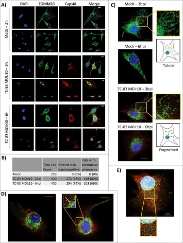 Figure 3. VEEV capsid localized in the mitochondria of infected cells. (A) Confocal images showing the co-localization of VEEV capsid (red) with mitochondrial marker TOMM20 (green). (B) Cell count summary of perinuclear phenotype observed in panel (A). (C) Magnified images of uninfected U87MGs displaying healthy, tubular mitochondria networks, and infected cells displaying a perinuclear clustering of mitochondria. (D). Confocal images showing perinuclear clustering of TOMM20 (green), and partial co-localization with VEEV capsid (red) (see arrow). E) Confocal images showing no co-localization between ER marker calnexin (green) and VEEV capsid (red). Scale bar indicates 5µm. A, C-E) Nuclei stained with DAPI (blue). (A, C-D) Scale bars indicate 10µm
