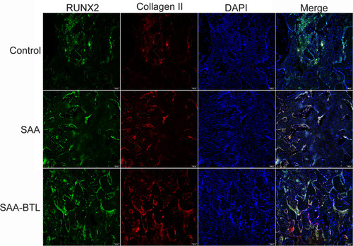 Figure 5 Immunofluorescence analysis of collagen II and RUNX2 expression in fracture calluses at the 4th week post-surgery. RUNX2 and collagen II expression were quantified in sections of the callus. These data are shown in Figure 7C.