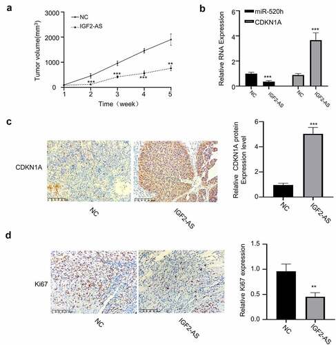 Figure 6. IGF2-AS over-expression in HepG2 cells inhibits xenograft tumor growth by regulating miR-520h/CDKN1A axis in vivo. (a) Tumor volume (n = 5 each). (b) miR-520h and CDKN1A expressions by qRT-PCR assay. (c) CDKN1A and (d) Ki-67 expressions by immunochemistry. **p < 0.01, ***p < 0.001,##p < 0.01, ###p < 0.001