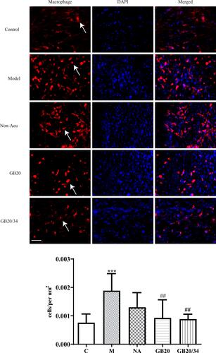 Figure 5 Electroacupuncture (EA) treatment decreased the number of dural macrophages. Scale bar = 50 μm. Model group vs Control group (***P<0.001), GB20, GB20/34 group vs Model group (##P<0.01).