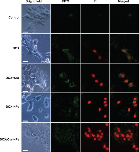 Figure 8 Annexin-V/PI double-staining assay in HepG2 cells.Notes: After treating with DOX, DOX+Cur (1:1), DOX-NPs, and DOX/Cur-NPs (1:1) for 24 hours, HepG2 cells were stained with Annexin V-FITC and PI and analyzed by fluorescence microscopy. Green: stained with Annexin V-FITC; red: stained with PI; mixture: stained with both Annexin V-FITC and PI. Apoptotic cells were highlighted by FITC, PI, and their merged images. Scale bar =50 μm.Abbreviations: FITC, fluorescein isothiocyanate; PI, propidium iodide; DOX, doxorubicin; DOX+Cur, physical mixture of doxorubicin and curcumin; DOX-NPs, doxorubicin-loaded lipid nanoparticles; DOX/Cur-NPs, doxorubicin and curcumin codelivery lipid nanoparticles.