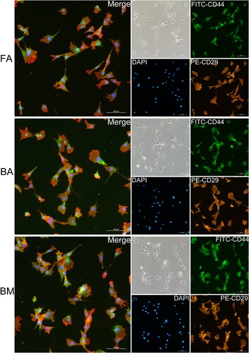 Figure 3. Immunofluorescence staining of FA-MSCs, BA-MSCs, and BM-MSCs. All nuclei are stained with DAPI (blue). Co-expressions of CD29 (clone TS2/16) and CD44 (clone 25.32) by different groups of MSCs are confirmed. Scale bar: 100 μm. FA, fibrous ankylosis; BA, bony ankylosis; BM, bone marrow; MSCs, mesenchymal stromal cells.