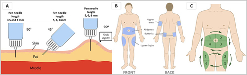 Figure 1 Proper Insulin Injection Technique Using Pen Needle. (A) needle length 3.5–4mm: insert the needle into the skin quickly without pinching at a 90° angle to the area to be injected; needle length 5,6,8mm: insert the needle at 45° angle without pinching or at 90° angle with pinch slightly. When the needle is inserted, press the piston slowly until the dose indicator shows “0”. Once the insulin is completely injected, allow the needle to remain in the skin for up to a count of 10. Then pull the needle out of the skin (if the skin is being pinched, release after the needle is pulled out of the skin). (B) Options of insulin injection sites. Front: abdomen (avoid injection <1 cm from umbilicus. The injection area may include 1 cm above pubic symphysis, 1 cm from the lowermost rib and the lateral abdominal wall), thighs (upper 1/3 of antero-lateral thigh). Back: arms (middle 1/3 of posterior upper arm), buttocks (use the lateral upper area). (C) Options of insulin injection rotation, which is important to avoid lipohypertrophy (LH) and to ensure optimal absorption. Injection site should be in one area and change site once a week with distance between sites ≥1 cm.Citation19