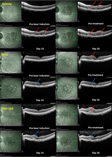 Figure 2 Representative optical coherence tomography (OCT) images for vehicle, bevacizumab and PRO-169 on pre-laser induction, pre-treatment, Days 14 and 28 after intravitreal injection. The high reflect light echogenic mass (red arrows) was detected in the eyes on Day 19 after laser photocoagulation (Day −2). The light echogenic mass decreases after IVT injection (Day 14 and 28) compared with pre-treatment in bevacizumab and PRO-169 groups (blue arrows).