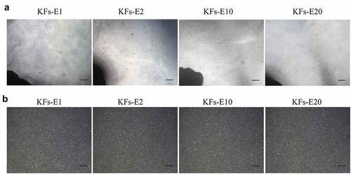 Figure 2. Homogeneous KFs isolated from long-term cultured keloid explants. a Representative images of keloid explants cultured for 12, 5, 5, and 5 days after the 1st, 2nd, 10th, and 20th cycle of explant culture, respectively (× 40, bar = 200 μm). b Representative images of P1 KFs derived from E1, E2, E10 and E20, respectively (× 40, bar = 200 μm).