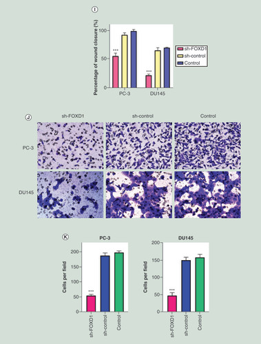 Figure 7. In vitro, the knockdown of FOXD1 inhibits cell proliferation, migration and invasion of prostate cancer. (A) The relative expression of FOXD1 was investigated by quantitative real-time PCR in PCa cell lines LNCaP, DU145, PC-3, 22RV1 and a normal human prostate cell line WPMY-1. GAPDH was used as an internal control. (B) The expression of FOXD1 at protein level was evaluated by Western blot. (C) The relative expression of FOXD1 was investigated by qRT-PCR in PCa cell lines PC-3 and DU145 after lentivirus transfection. (D) The expression of FOXD1 at protein level was evaluated by Western blot after lentivirus transfection. (E) The effects of FOXD1 on the proliferation of PC-3 and DU145 cells were evaluated by Cell Counting Kit-8 tests. (F) The effects of FOXD1 on the proliferation of PC-3 and DU145 cells were evaluated by colony formation tests. (G) Statistical analysis of the results from colony formation assays. (H) The effects of FOXD1 on the migration of PC-3 and DU145 cells were evaluated by wound healing assays. (I) Statistical analysis of the results from wound healing assays. (J) Representative images of transwell assays from control, sh-control and sh-FOXD1 groups of PC-3 and DU145 cells. (K) Statistical analysis of the results from transwell assays. *pÂ <Â 0.05, **pÂ <Â 0.01, ***pÂ <Â 0.001 vs the sh-control group.