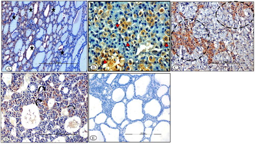 Figure 8. BTV-1 infected sheep at 65th DPI, ABC-IHC-DAB, immunohistochemically stained section, polyclonal BTV-1 primary antibody. (A) Thyroid section showing positive immunolabeling in the cytoplasm of the follicular epithelial cell (asterisk) at 14th DPI, ×200. (B) Adrenal gland section showing positive immunolabelling in the cytoplasm of the cell of zona fasciculata (arrowhead) at 7th DPI, ×400. (C) Adrenal gland section showing positive immunolabelling in the cytoplasm of the cell of zona reticularis projecting in the medullary region (dotted circle) of the gland at 14th DPI, ×400. (D) Pituitary gland showing positive immunolabeling in the cytoplasm of the cell of the adenohypophysis (curved arrow) at 14th DPI, ×200. (E) Antibody control section devoid of any immunolabeling, IHC-DAB, 14th DPI, ×200.