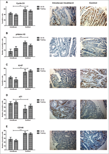 Figure 3. Anti-tumor effect of irinotecan. (A–C) Irinotecan treatment significantly inhibited tumor cell proliferation as shown by differential expression of Cyclin D1, pHiston H3, and Ki-67. (D) This corresponded with an upregulation of the CDKI p21. (E) CD146, a marker for endothelial cells, was significantly down-regulated in irinotecan treated animals. Representative photomicrographs of irinotecan treated (middle panels) and control (right panels) tumor specimens (magnification 200x). *P < 0.05, **P < 0.01, ***P < 0.001.