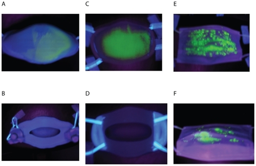 Figure 4 UV photographs of facemasks after being sprayed with fluorescent stains. The outer surface of facemask A (A), Inner surface of facemask A (B); Outer surface of facemask B (C); Inner surface of facemask B (D); Outer surface of surgical facemask (E), and inner surface of surgical facemask (F).
