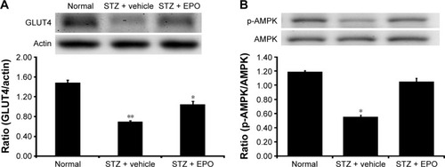 Figure 5 EPO-induced changes in GLUT4 expression (A) and AMPK phosphorylation (B) in the soleus muscle of type 1-like diabetic rats.