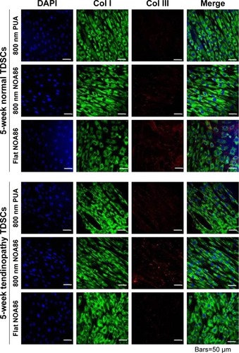 Figure 3 Expression of Col I and Col III collagen was observed in the TDSCs extracted from 5-week normal and 5-week tendinopathy models cultured on the 800 nm NOA86 (2.4 GPa), flat NOA86, and 800 nm PUA (19.8 MPa) substrates.Notes: In the 5-week normal and 5-week tendinopathic conditions, there was no difference in expression of type I collagens according to nanotopographic cues and substrate stiffness. Expression of Col III collagen in 5-week normal condition was slightly higher in flat NOA86 than in 800 nm PUA or in 800 nm NOA86, while this expression in 5-week tendinopathic conditions was slightly higher in 800 nm NOA86 than in 800 nm PUA or in flat NOA86.Abbreviations: Col I, type I collagen; Col III, type III collagen; NOA86, Norland Optical Adhesive 86; PUA, polyurethane; TDSCs, tendon-derived stem cells.