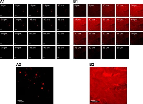 Figure 7 Confocal laser scanning microscopy images show x–z plane serial penetration of a porcine intestine treated with (A1) nile red in fish oil and (B1) nile red-loaded ME 4 at a time of 3 h, scale bar represents 100 µm. The (A2) and (B2) images are the intensity projections through the z-axis of (A1) and (B1), respectively. The scale bar represents 100 µm.Abbreviation: ME, microemulsion.