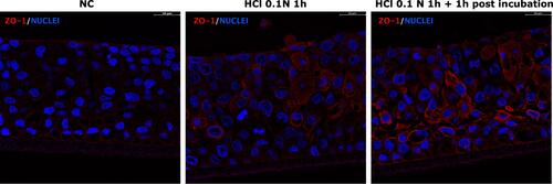 Figure 7 Immunofluorescent staining of ZO-1 in untreated HO2E/12 tissues (NC) and HO2E/12 exposed to HCl 0.1N (pH 1.2) for 1h without (series HCl 0.1N 1h) or with 1h post incubation period (series HCl 0.1N 1h + 1h post incubation). Nuclei are stained in blue (DAPI). Magnification 63x. Scale bar = 30 μm. Representative images selected within triplicate series.