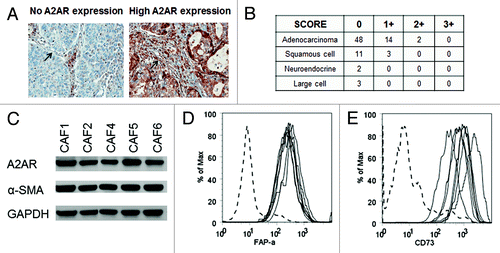 Figure 2. CAFs express A2AR. (A) IHC analysis of A2AR expression in a lung cancer TMA. Representative pictures of 0 and 2+ A2AR expressing fibroblasts are shown. Arrow shows the fibroblast in the picture. (B) Table showing the expression of A2AR in the fibroblasts of lung tumors from the TMA. 0, no expression; +1 to +3, increasing expression of A2AR. (C) Immunoblot analysis of A2AR and α-SMA in a panel of 5 CAF. Expression of (D) FAP-α and (E) CD73 were detected by flow cytometric analysis on lymphocytes (dotted line, negative control) and a panel of 5 CAF (all other lines).