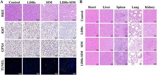 Figure 6 (A) H&E, ki67, TUNEL, GPX4 staining results of tumor sections in different treatment groups (scale bar = 20 μm); (B) H&E staining images of heart, liver, spleen, lung, kidney and other organs treated with different materials (scale bar = 50 μm).