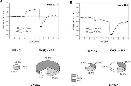 Figure 2 Exemplary FMSF traces recorded for two patients with diabetic foot ulcers: (A) group A, code 5015, female, age 41 y., DM2, (B) group B, code 125, female, age 40 y., DM1.