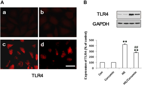Figure 3 Influence of Curcumin on expression of TLR4 in NRK-52E cells. (A) The NRK-52E cells were pre-treated with Curcumin (20 μM) for 24 h. Following Curcumin treatment, the medium was changed and cells were treated with 30 mM HG for 48 h. The TLR4 protein was stained and observed under a fluorescence microscope as described in Materials and Methods. (A) a. control group; b. Curcumin group; c. HG group; d. HG/Curcumin group (magnification was ×400, Scale bars=30 μm). (B) The protein expression was detected by Western blotting, relative expression levels of TLR4 was, respectively, determined by densitometry and normalized by GAPDH, and data are represented as percentages of the control group. (**P < 0.001 vs Control group, ##P < 0.001 vs HG).