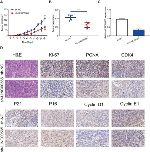 Figure 5 LINC00565 regulates the tumor growth in vivo. (A) The growth of tumors from sh-LINC00565 group were markedly slower than these from sh-NC group. (B) The tumors dissected from sh-LINC00565 group node mice were lighter than the sh-NC group. (C) qRT-PCR verified that LINC00565 expression was lower in sh-LINC00565 group than that in sh-NC group. (D) Immunohistochemistry showed that PCNA, Ki-67, Cyclin D1, Cyclin E1 and CDK4 were markedly reduced in LINC00565 knockdown group compared with NC group, nevertheless, P16 and P21 showed the opposite effect. ***P < 0.001.