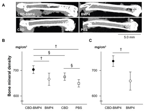 Figure 5 CBD-BMP4 accelerates bone mineral density. CBD-BMP4, BMP4, CBD (100 ng in 10 μL PBS), or vehicle PBS (10 μL) were directly injected into mouse femurs (five mice per each group). At 4 weeks after the injection, the femurs were scanned by micro-CT. (A) Representative images from each group. Bone mineral density was calculated by micro-CT at (B) 4 weeks and (C) 8 weeks after the injection.Notes:§P < 0.05; †P < 0.01.Abbreviations: CBD, collagen-binding domain; BMP4, bone morphogenetic protein-4; PBS, phosphate buffered saline; CT, computed tomography.