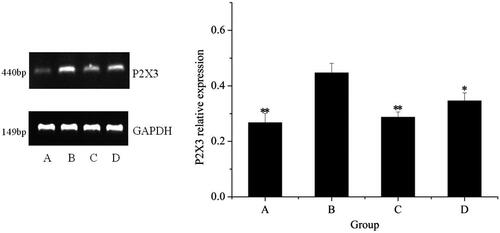 Figure 6. Analysis of P2X3 mRNA expression in forelimb's articular cavities. A, control group; B, model group; C, positive group; D, NI group. *P < 0.05, **P < 0.01, vs. controls.