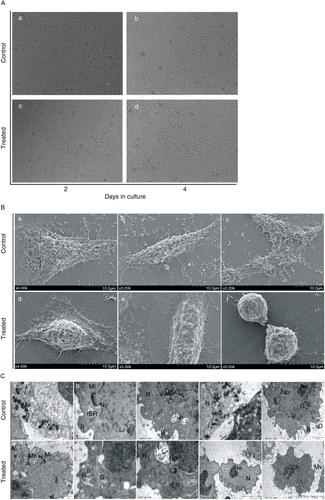 Fig. 2 Morphological observation of RPE cells treated with 100 µg/ml PSPA. Fig. 2A, phase-contrast micrographs of RPE cells cultured without PSPA (control) for (a) 2 days and (b) 4 days, and with 100 µg/ml PSPA (treated) for (c) 2 days and (d) 4 days. Scale bar: 20 μm. Fig. 2B, scanning electron micrographs of RPE cells cultured without PSPA (control) and with 100 µg/ml PSPA (treated) for 2 days, showing the surface morphology. Scale bar: 10 μm. Fig. 2C, transmission electron micrographs of RPE cells cultured without PSPA (control) and with 100 µg/ml PSPA (treated) for 2 days, showing the ultrastructure of RPE cells (B, buds; Ch, chromosome; D, digitations; G, golgi apparatus; L, lysosome; Me, melanin granule; Mi, mitochondrion; Mv, microvilli; N, nucleus; Nn, nucleoli; Np, nuclear pores; P, phagocytic vacuoles; rER, rough endoplasmic reticulum, R, ribosomes). Scale bars: 5 μm for (i) and (j); 2 μm for (a), (c), (e), (d), and (f); 1 μm for (b), (g), and (h).