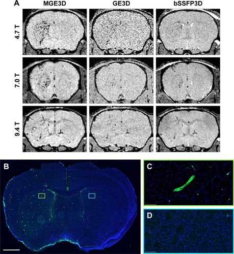 Figure 1 (A) Representative in vivo images of mice 1 h post-VCAM-MPIO injection at different magnetic fields. Three sequences of MGE3D, GE3D, and bSSFP3D are shown from a 3D dataset. Intense low signal areas on the left side of the brain reflect the specific retention of MPIO on acutely activated vascular endothelium with visually absent contrast effect in the contralateral control hemisphere. MGE3D demonstrates better visualization of hypointensities compared with other sequences. (B–D) Histological assessment of VCAM upregulation at the injection side.Notes: Green vessels show unilateral upregulation of VCAM, nuclei are shown in blue. Scale bar: 1 mm.Abbreviations: bSSFP3D, balanced steady-state free precession 3D; GE3D, gradient echo 3D; MGE3D, multi-gradient echo 3D; MPIO, microparticles of iron oxide; VCAM, vascular cell adhesion molecule.