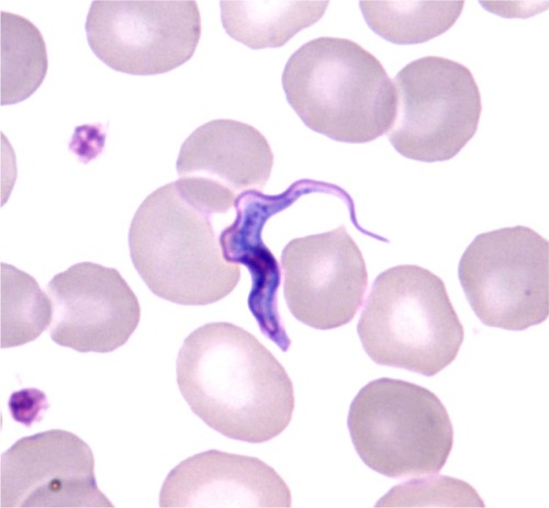 Figure 1 Trypanosoma brucei gambiense: bloodstream slender trypomastigote (thin smear, May Grunwald Giemsa, ×1000).