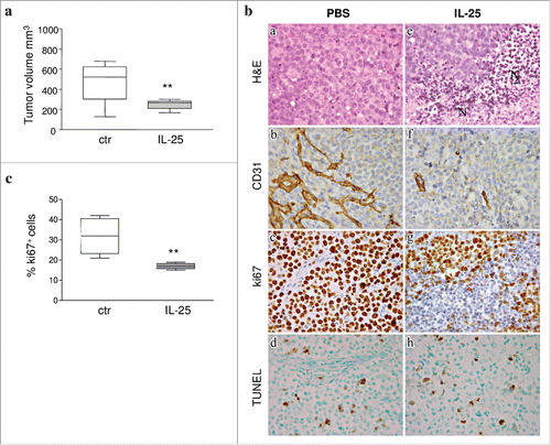 Figure 3. Role of IL-25 on in vivo B-NHL growth. (A) Volume of tumors grown s.c. in mice treated with PBS or IL-25 (1µg) 20 days after SU-DHL-4 cell injection. Results are expressed in box plot, as median tumor volume mm3, maximum, minimum and first and third quartile (**p = 0.002). (B) Tumors developed after s.c. injection of SU-DHL-4 cells in PBS treated SCID/NOD mice consisted of a mixture of small and large lymphoid cells with centrocyte and centroblast morphology (a). These tumors displayed a distinct vascularization (b), a strong proliferative activity (c) and some apoptotic events (d). The histologic features of SU-DHL-4 tumors appeared heavily compromised by rhIL-25 treatment, since these tumors were characterized by wide areas of ischemic necrosis (N) (e), defective vascularization (f), and decreased proliferation (g), whereas apoptotic events (h) were comparable to those observed in control tumors (d) (Magnification: X400). (C) Flow cytometric analysis of cell proliferation in cell suspensions from explanted SU-DHL-4 cell tumors, as assessed by Ki67 staining. Results for 6 PBS and 6 IL-25-treated mice are expressed as median % positive cells, maximum, minimum and first and third quartile (**p = 0.0049).