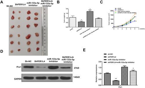 Figure 7 LncRNA FER1L4 promoted OSCC progression through targeting miR-133a-5p/Prx1 axis in vivo. The SCC-9 cells were transfected with sh-NC, sh-FER1L4, miR-133a-5p inhibitor or co-transfected with sh-FER1L4 and miR-133a-5p inhibitor for 48 h, the cells were separately subcutaneously inoculated into the left and right flank in the dorsal of the nude mice. (A) The representative images of subcutaneous tumor from different groups. (B and C) Tumor weights (B) and volumes (C) from mice of different groups were evaluated on the 28th day. (D and E) The protein level of Prx1 in OSCC tissues from different groups were detected by Western blot (D) and quantitative analysis (E). Each experiment was repeated three times. **p < 0.01 vs sh-NC group and #p < 0.05 vs sh-FER1L4 group.