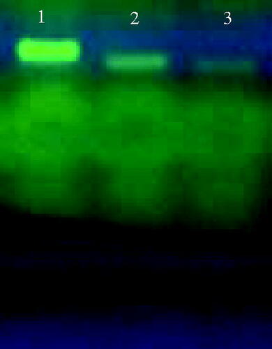 Figure 12. DNA cleavage study of green/chemically synthesized Ag nanoparticles on genomic bacterial DNA, lanes 1: non treated DNA, lanes 2: chem-AgNP treated DNA, lanes 3: green-AgNPs treated DNA.