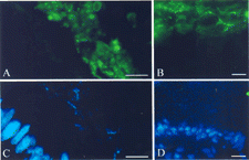 Fig. 3 Association of IgA with biofilms adjacent gut epithelium. Samples were submerged in OCT, flash-frozen, sectioned, and stained with goat anti-rat IgA or goat anti-human IgA followed by a fluorescein labeled anti-goat IgG. Sections were counterstained with the nucleic acid-specific stain DAPI. The presence of IgA (indicated by green fluorescence, A and B) and nucleic acid (indicated by blue fluorescence, C and D) was evaluated by using a fluorescence microscope. One section from the rat cecum (A and C) and one section from the human appendix (B and D) are shown. The portion of the sections photographed was kept constant so that the regions in (A) and (B) correspond exactly to the regions in (C) and (D), respectively. Biofilms were characterized by heavy staining for IgA (green fluorescence) and moderate staining for nucleic acid (blue fluorescence), whereas the nuclei of the gut epithelium were characterized by heavy staining for nucleic acid but not for IgA. The bar represents 15 μm.