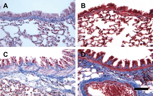 Figure 3 Representative photomicrographs of mouse lung stained with Masson’s trichrome. L-selectin +/+ saline (A), L-selectin −/− saline (B), L-selectin +/+ OVA, L-selectin −/− OVA. Bar = 100 μm.