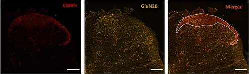 Figure 1. Immunohistochemical staining approach to identify the CGRP+ SDH region and study GluN2 subunit distribution. Left) Laminae I and IIo of the superficial dorsal horn (SDH) are immunopositive for punctate CGRP (red) staining, labeling the relatively nociceptive-specific marginal region of the SDH. Middle) Co-labeling with an antibody against a specific GluN2 subunit (GluN2B here, yellow) is performed on the same spinal sections stained for CGRP. Right) Overlay of CGRP and GluN2B immunostaining. The marginal SDH that is CGRP-positive is outlined (white line), and then GluN2 subunit immunoreactivity is described and quantified in this CGRP+ SDH region in comparison to the remaining deep dorsal horn (DDH) laminae. Scale bar: 200 μm
