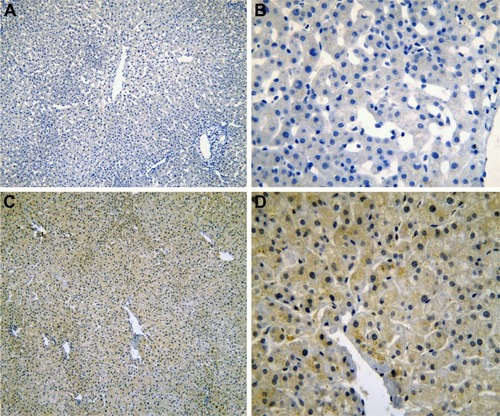 Figure 4 The IHC of normal liver tissues (para-HCC).