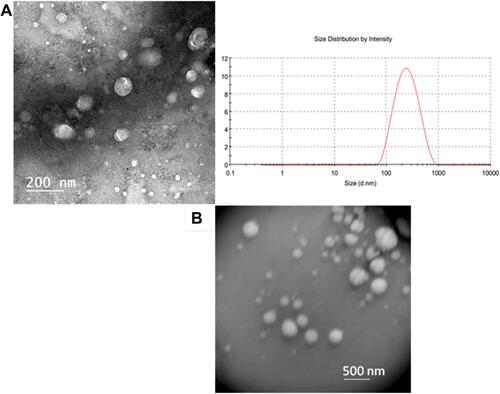 Figure 4 (A) TEM images and size distribution of Coscinoderma sp.-containing liposomes, (B) TEM image of empty liposomes.