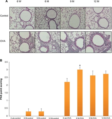 Figure 5 Goblet cell hyperplasia in lung tissue according to age in the acute asthma model. Representative photomicrographs of PAS stained lung sections (A). Quantification of the PAS-stained area by point scoring (B).Notes: Values shown are mean ± SEM (n = 8–12/group); *P < 0.05, compared with the 6-week-old OVA group.Abbreviations: W, weeks; wk, weeks; M, months; OVA, ovalbumin; PAS, periodic acid-schiff; SEM, standard error of the mean.