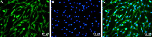 Figure 1. Immunofluorescence staining of hippocampal neurons. A: Green staining indicated NSE positive cells. B: Photomicrographs of DAPI staining of hippocampal neuron nucleus (Blue). C: Green staining indicated NSE positive cells and blue staining indicated nuclei. The hippocampal neuronal cells was obtained from the Wistar rats (SPF, 18-day-old, weighing 40 to 50 g, half male and half female, n = 20), all rats were sacrificed by cervical dislocation after anesthesia.