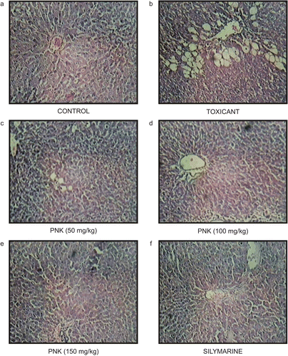 Figure 1.  Photomicrograph of liver section taken from rats against CCl4-induced hepatotoxicity. (A) Normal control rat. Section of liver showing hepatic cells with nuclei, cytoplasm, central vein, and portal triad. (B) Liquid paraffin: CCl4-treated rats. Section of liver showing marked necrosis, inflammation, lymphocytic infiltration severe. (C) PNK (50 mg/kg)-treated rats. Section of liver showing necrosis, lymphocytic infiltration and occasional regenerating parenchymal cells. (D–F) PNK (100 and 150 mg/kg) and silymarin-treated rats. Section of liver showing mild inflammatory changes and greater area of regeneration.