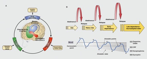 Figure 1 (Left) Three stages of the addiction cycle: binge/intoxication, withdrawal/negative affect, and preoccupation/anticipation. These three stages reflect incentive salience/pathological habits, reward deficits/stress surfeit, and executive function deficits, respectively, to provide a powerful impetus for compulsive drug-seeking behavior associated with drug addiction. These domains of dysfunction correspond to neuroadaptations that reflect allostatic changes in three key neurocircuits to mediate compulsive drug seeking: basal ganglia, extended amygdala, and prefrontal cortex, respectively. (Top right) The progression of alcohol dependence over time. The schematic illustrates the shift in underlying motivational mechanisms. From initial, positively reinforcing, pleasurable alcohol effects, the addictive process progresses over time to being maintained by negatively reinforcing relief from a negative emotional state. (Bottom right) The a-process represents a positive hedonic or positive mood state, and the b-process represents a negative hedonic or negative mood state. The affective stimulus (state) has been argued to be the sum of both the a-process and b-process. An individual who experiences a positive hedonic mood state from a drug of abuse with sufficient time between readministering the drug is hypothesized to retain the a-process. An appropriate counteradaptive opponent process (b-process) that balances the activational process (a-process) does not lead to an allostatic state. Changes in the affective stimulus (state) in an individual with repeated frequent drug use may represent a transition to an allostatic state in the brain reward systems and, by extrapolation, a transition to addiction. Notice that the apparent b-process never returns to the original homeostatic level before drug taking begins again, thus creating a progressively greater allostatic state in the brain reward system. The counteradaptive opponent-process (b-process) does not balance the activational process (a-process) but in fact shows residual hysteresis. Although these changes that are illustrated in the figure are exaggerated and condensed over time, the hypothesis is that even during post-detoxification (a period of protracted abstinence), the reward system still bears allostatic changes. The following definitions apply: allostasis, the process of achieving stability through change; allostatic state, a state of chronic deviation of the regulatory system from its normal (homeostatic) operating level; allostatic load, the cost to the brain and body of the deviation, accumulating over time, and reflecting in many cases pathological states and accumulation of damage. Bottom right panel from reference 3: Koob GF, Le Moal M. Drug addiction, dysregulation of reward, and allostasis. Neuropsychopharmacology. 2001 ;24(2):971 29. Copyright © Nature Publishing Group, 2001 . Top right panel from reference 4: Heilig M, Koob GF. A key role for corticotropin-releasing factor in alcohol dependence. Trends Neurosci. 2007;30(8):399-406. Copyright © Elsevier Applied Science Publishing, 2007