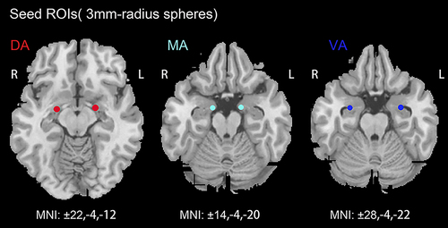 Figure 1 The amygdala subregions.