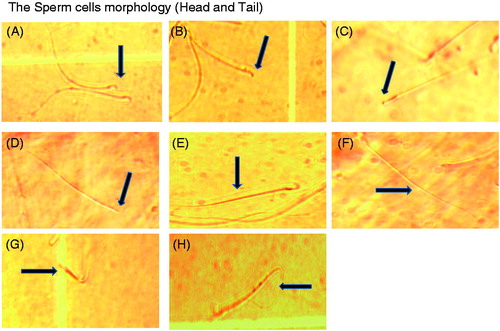 Figure 1. The sperm head and tail morphology, A (Pin head); B (Round head); C (long head); D (Deformed head); E (Short tail); F (long tail); G (Cut off) and H (abnormal tail) Olympus microscopic (40×).