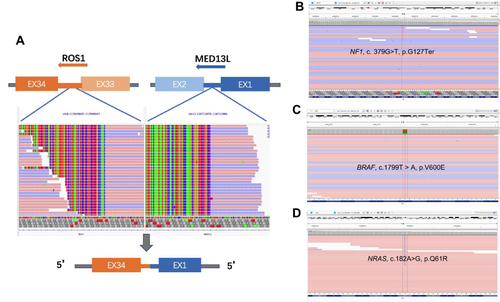 Figure 2 IGV illustration of ROS1 novel fusion and potential drug-resistant mutations. (A) MED13L-ROS1(M1:R34); (B) NF1 p.G127Ter; (C) BRAF, c.1799T > A, p.V600E; (D) NRAS, c.182A>G, p.Q61R.
