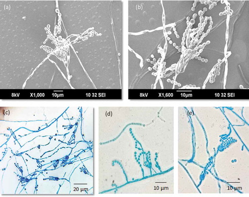 Figure 5. Conidiophores branching pattern of WSR 62: a, b. Scanning electron micrographs of conidiophore; c-e. Light microscopy: Short-to-moderate-sized conidiophores; solitary phialides and divaricate conidiophores.