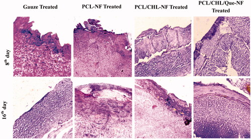 Figure 9. Haematoxylin − eosin stained slice showing histological changes in granulation tissue after treatment with gauze, PCL-NF, PCL/CHL-NF and PCL/CHL/Que-NF.