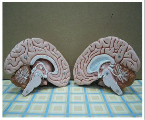 Figure 2. Classic 5-Part Brain (C18) models, manufactured by 3B Scientific Corporation.