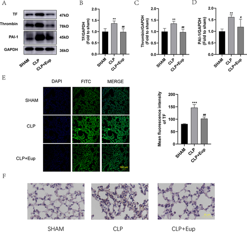 Figure 6 Effects of Eupatilin on the expression of coagulation indicators and fibrin deposition in lung tissue of septic mice. (A-D) The protein expression of TF, thrombin and PAI-1 in the lung tissue were analyzed by Western blot. (E) TF (green) fluorescence images (scale bar: 100 µm) of lung tissue were captured under the confocal laser microscope. (F) The images of fibrin deposition in the lung tissue from three mice groups were detected by immunohistochemical staining (400 ×, scale bar: 25 µm). n≥3 per group, one-way ANOVA test. **p < 0.01, ***p < 0.001, versus SHAM group; #p < 0.05, ##p < 0.01, versus CLP group.